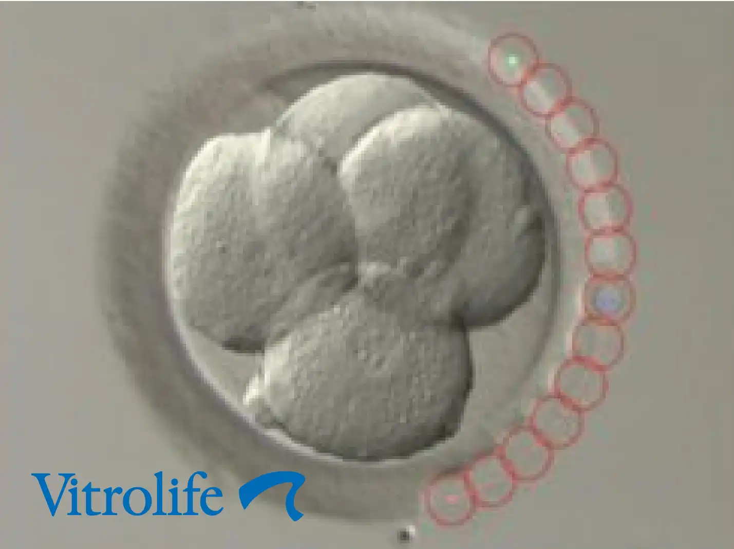 Vitrolife Laser & imaging systems